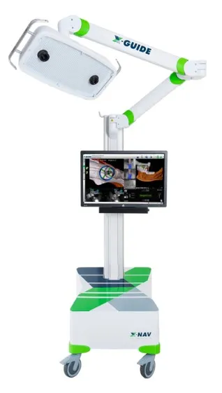 Keystone Dental Announces Market Launch of Nexus Connect, the First A.I.  Enabled Intraoral Implant-Scan Analyzer for the Nexus iOS Full-Arch  Solution